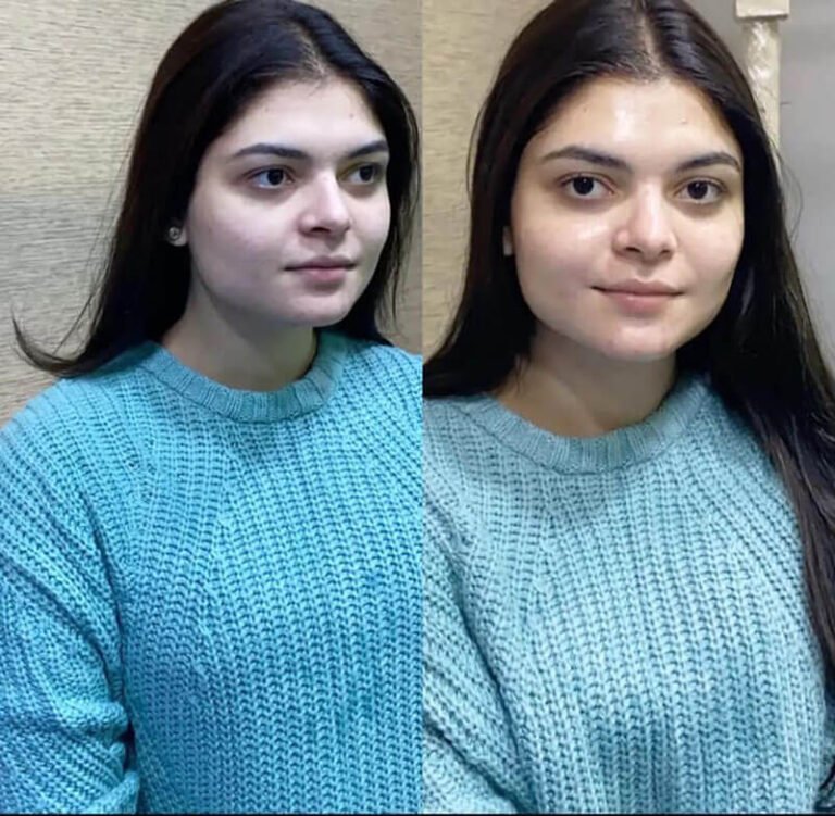 hydrafacial lahore