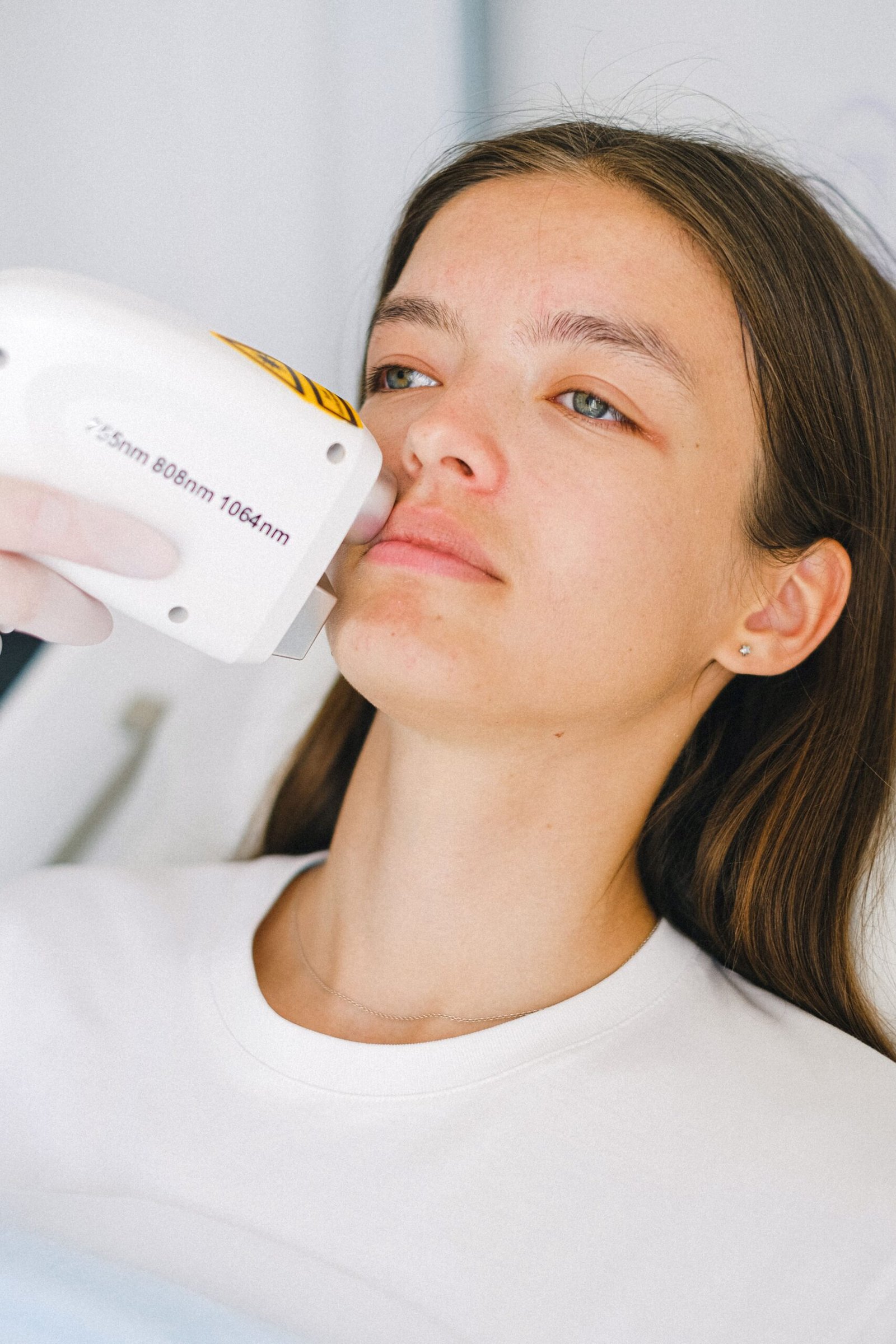 Lip lightening laser treatment for dark lips in Pakistan
